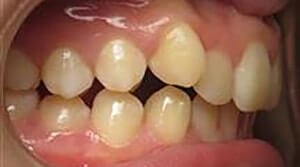 Before