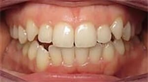 Before